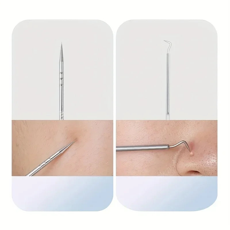 Stainless Steel Skin Care Tool Set For Blackhead And Pimple