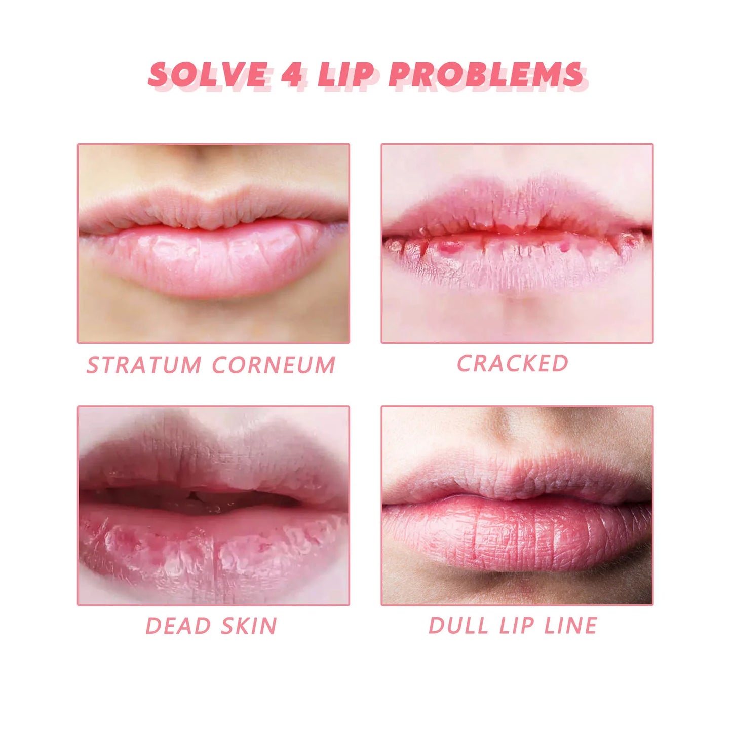 Peach Lip Scrub Exfoliates Dead Skin For Dry Lips Hydration
