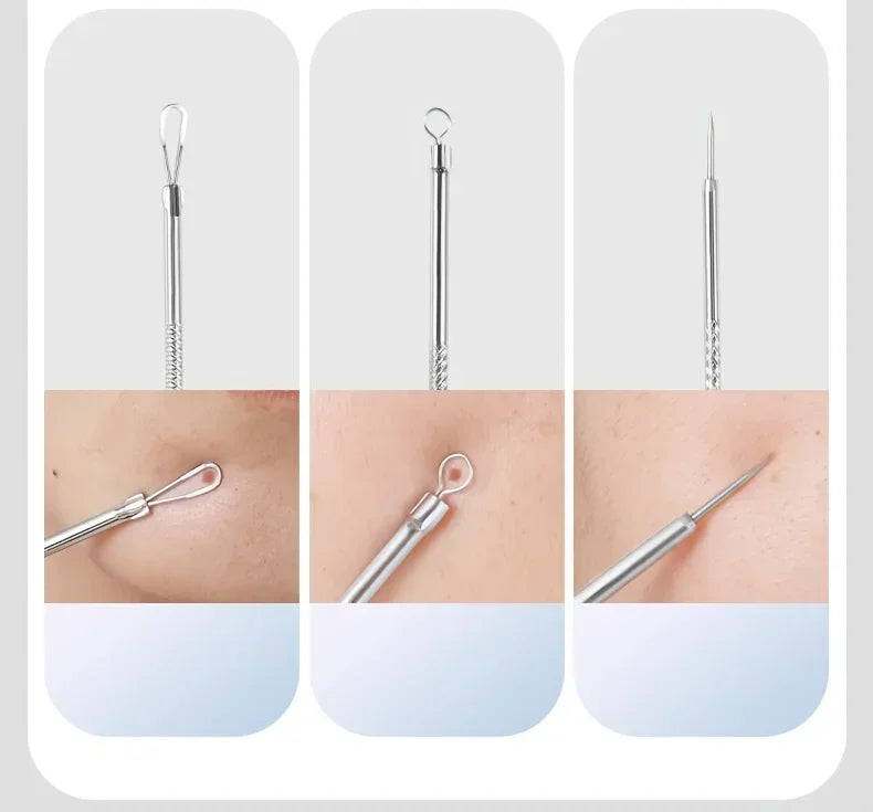 Stainless Steel Skin Care Tool Set For Blackhead And Pimple