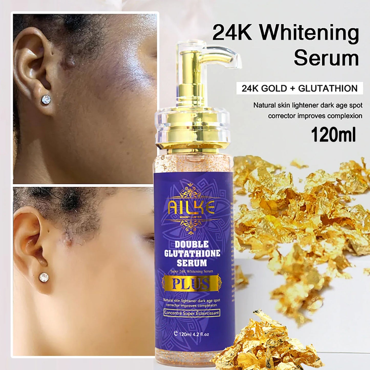 AILKE Brightening Body Milk For Uneven Skin Tone Dark Spots