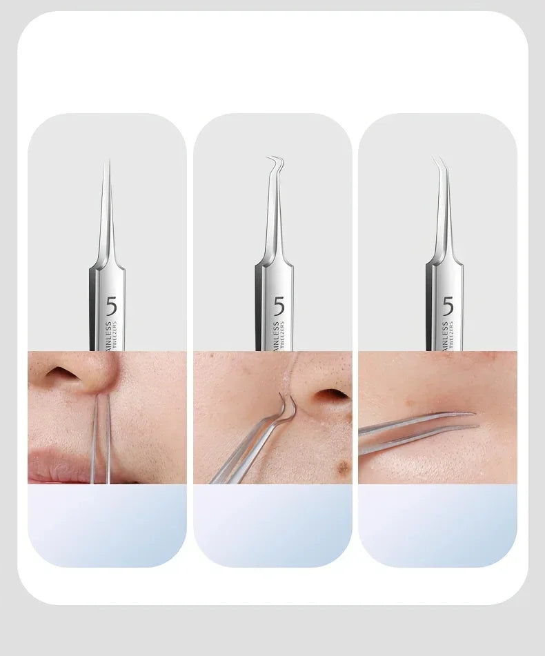 Stainless Steel Skin Care Tool Set For Blackhead And Pimple